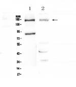 NPC1 Antibody in Western Blot (WB)