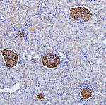 Podocin Antibody in Immunohistochemistry (Paraffin) (IHC (P))