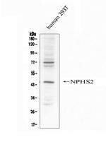 Podocin Antibody in Western Blot (WB)