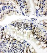 NRF1 Antibody in Immunohistochemistry (Paraffin) (IHC (P))