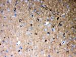 P2X5 Antibody in Immunohistochemistry (Paraffin) (IHC (P))