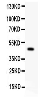 P2X5 Antibody in Western Blot (WB)