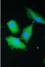 PARN Antibody in Immunocytochemistry (ICC/IF)