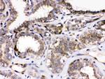 PARVA Antibody in Immunohistochemistry (Paraffin) (IHC (P))