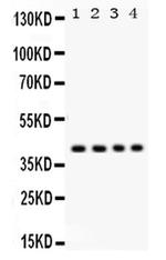 PARVA Antibody in Western Blot (WB)