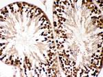 PBK Antibody in Immunohistochemistry (Paraffin) (IHC (P))