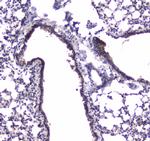 PDE4D Antibody in Immunohistochemistry (Paraffin) (IHC (P))