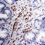 PDK1 Antibody in Immunohistochemistry (Paraffin) (IHC (P))