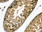 PDPK1 Antibody in Immunohistochemistry (Paraffin) (IHC (P))