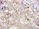 PF4 Antibody in Immunohistochemistry (Paraffin) (IHC (P))