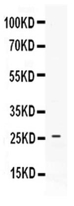 PF4 Antibody in Western Blot (WB)