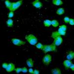 Profilin 2 Antibody in Immunocytochemistry (ICC/IF)