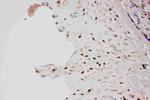 PIAS1 Antibody in Immunohistochemistry (Paraffin) (IHC (P))