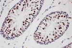 PIAS1 Antibody in Immunohistochemistry (Paraffin) (IHC (P))