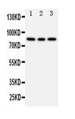 PIK3R2 Antibody in Western Blot (WB)