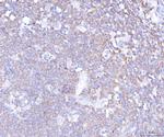 PLCG2 Antibody in Immunohistochemistry (Paraffin) (IHC (P))