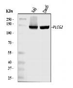 PLCG2 Antibody in Western Blot (WB)