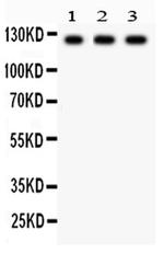 PLD1 Antibody in Western Blot (WB)