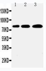 PLK2 Antibody in Western Blot (WB)