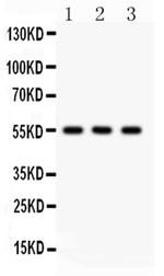 PLTP Antibody in Western Blot (WB)