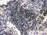 PML Antibody in Immunohistochemistry (Paraffin) (IHC (P))