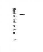 PMS2 Antibody in Western Blot (WB)