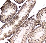 POLR2A Antibody in Immunohistochemistry (Paraffin) (IHC (P))