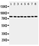 Cytochrome P450 Reductase Antibody in Western Blot (WB)