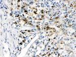 PPT1 Antibody in Immunohistochemistry (Paraffin) (IHC (P))