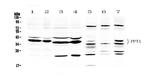 PPT1 Antibody in Western Blot (WB)