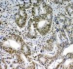 Blimp-1 Antibody in Immunohistochemistry (Paraffin) (IHC (P))