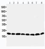 PRDX5 Antibody in Western Blot (WB)