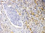 PRKAR1A Antibody in Immunohistochemistry (Paraffin) (IHC (P))