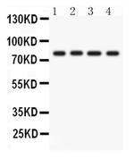 PKC eta Antibody in Western Blot (WB)