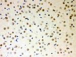 PKC lambda/iota Antibody in Immunohistochemistry (Paraffin) (IHC (P))