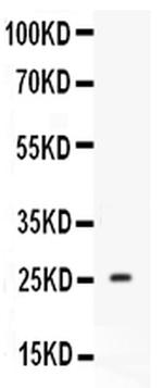 Prolactin Antibody in Western Blot (WB)