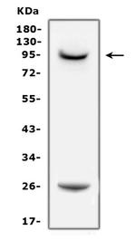 Prolactin Receptor Antibody in Western Blot (WB)