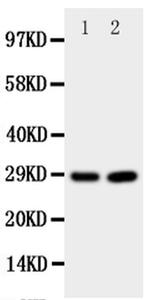 PrP Antibody in Western Blot (WB)