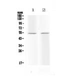 Protein C Antibody in Western Blot (WB)