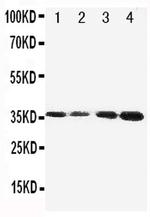 Protein C Antibody in Western Blot (WB)