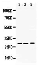 PSMA3 Antibody in Western Blot (WB)