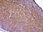 PTPN22 Antibody in Immunohistochemistry (Paraffin) (IHC (P))