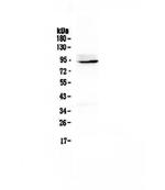 PTPN22 Antibody in Western Blot (WB)