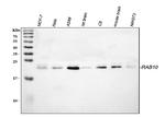 RAB10 Antibody in Western Blot (WB)