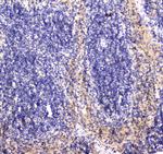 RAB27A Antibody in Immunohistochemistry (Paraffin) (IHC (P))