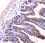 RAB27A Antibody in Immunohistochemistry (Paraffin) (IHC (P))