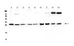 RAB27A Antibody in Western Blot (WB)