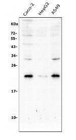 RAB8A Antibody in Western Blot (WB)