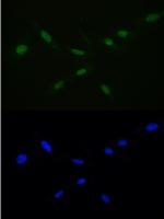 RAN Antibody in Immunocytochemistry (ICC/IF)