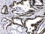 RAN Antibody in Immunohistochemistry (Paraffin) (IHC (P))